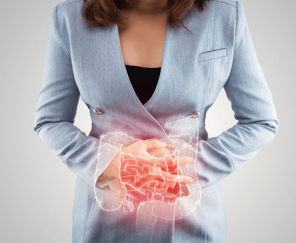 Sindromul de colon iritabil (IBS) și medicina funcțională