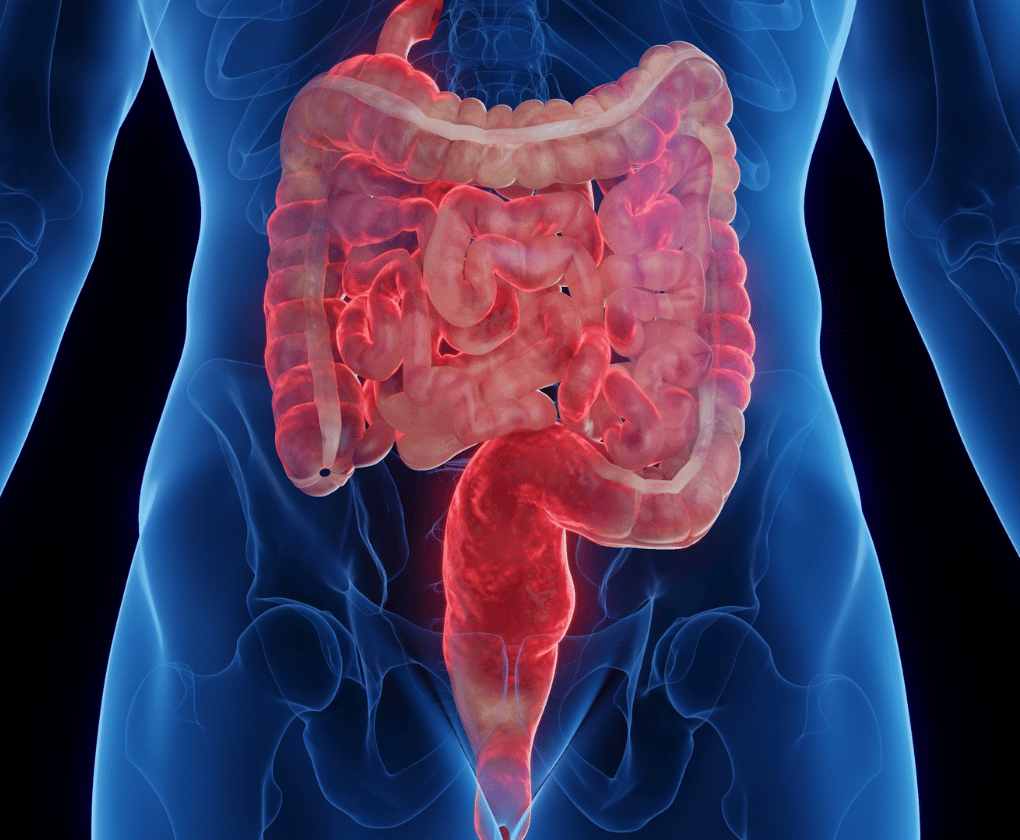 Probioticele vs. colita ulceroasă și boala Crohn