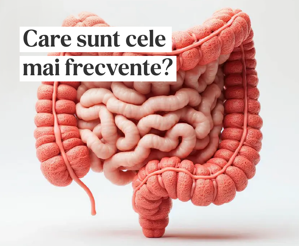 Simptomele intestinelor bolnave: cele mai frecvente 7