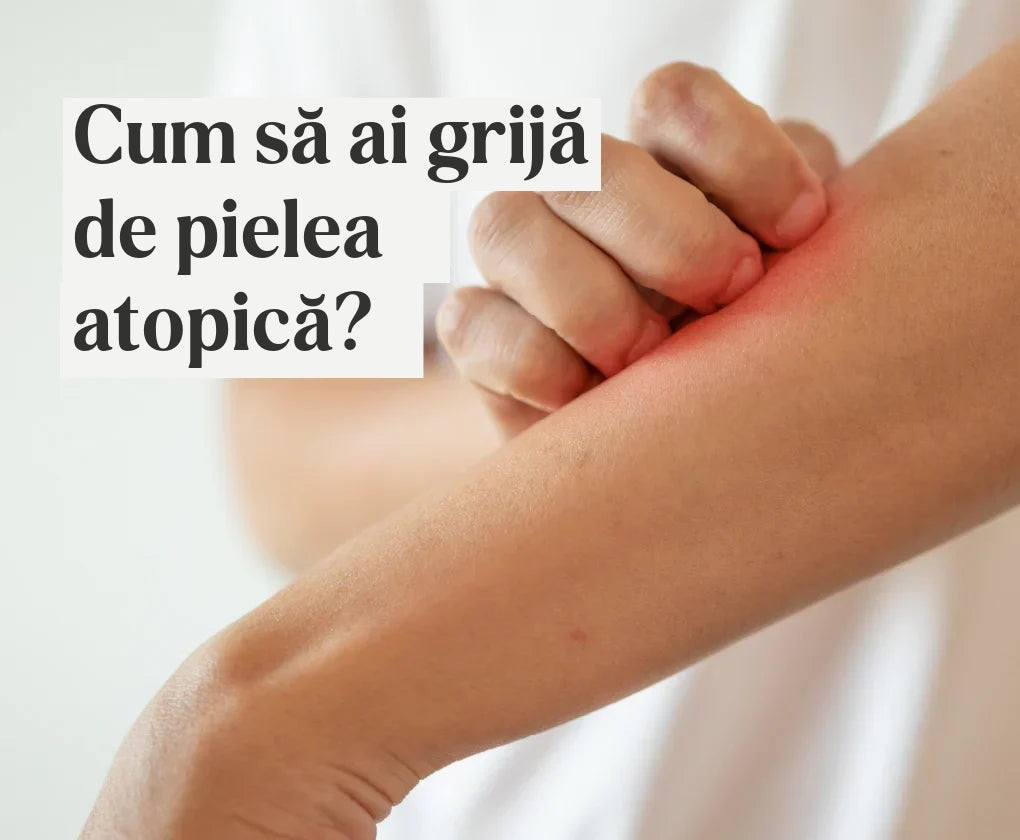 Eczema atopică – ce legătură are cu microbiota și cum se tratează?