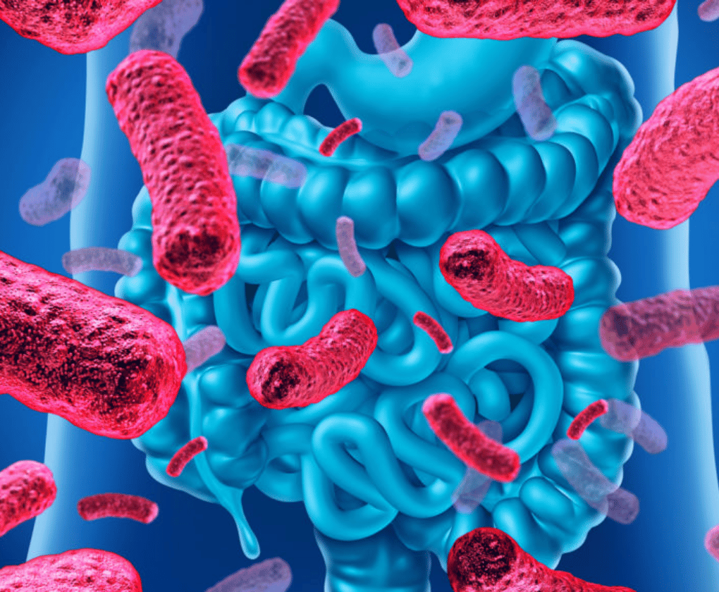 SIBO - când bacteriile noastre bune se înmulțesc excesiv