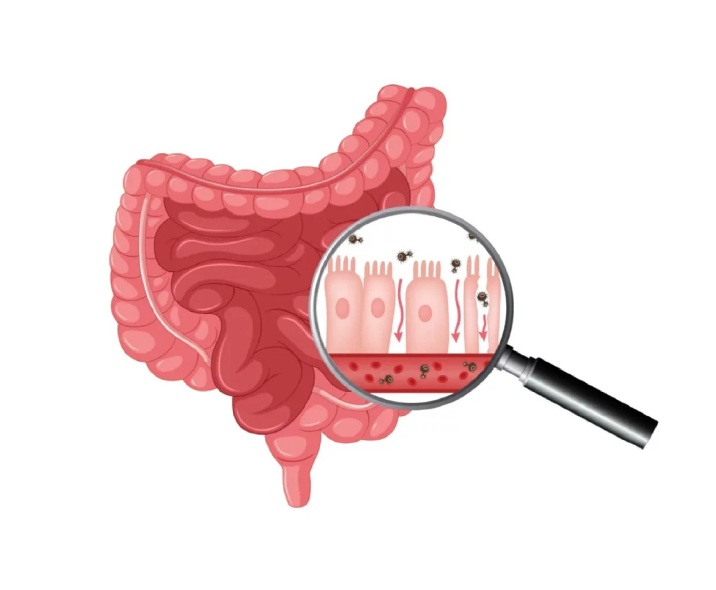 permeabilitate intestinală