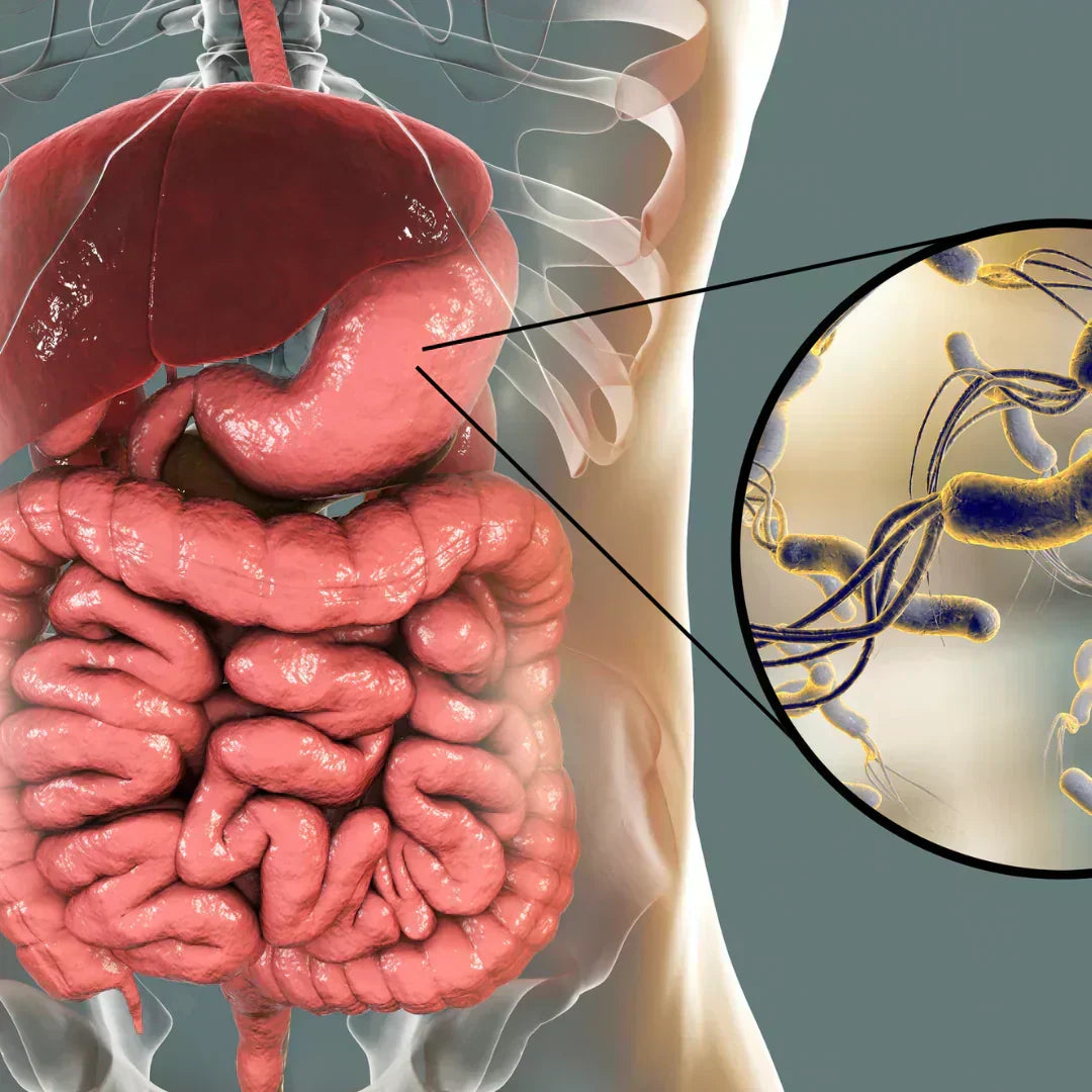 helicobacter pylori
